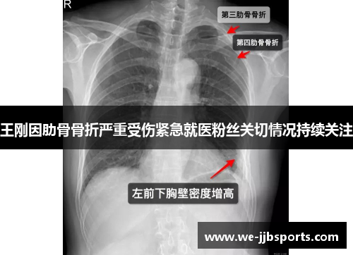 王刚因肋骨骨折严重受伤紧急就医粉丝关切情况持续关注 王刚因肋骨骨折严重受伤紧急就医粉丝关切情况持续关注